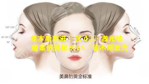 佳木斯前进 ☘ 区 🕷 激光祛痘案例揭秘2026「佳木斯激光祛斑哪里做得比较好」